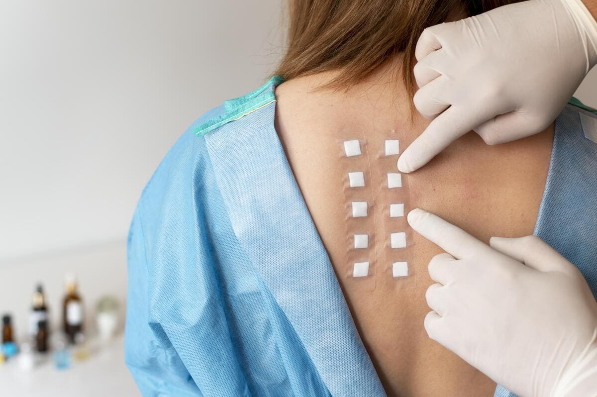 Pruebas de parche en CDMX: Diagnóstico especializado en alergias